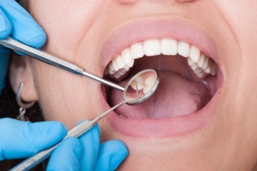 Лечение пульпита зубов